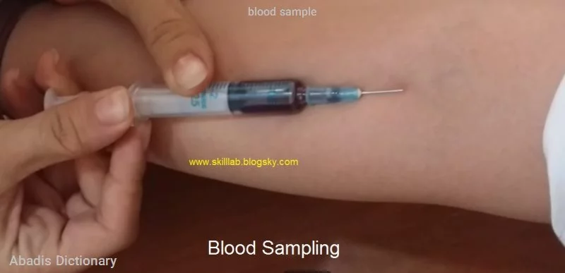 blood sample